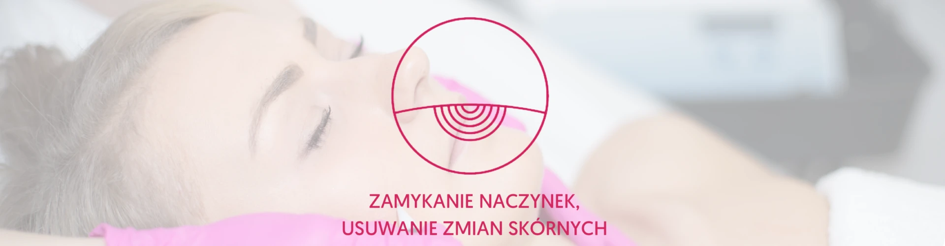 Zamykanie naczynek, usuwanie zmian skórnych